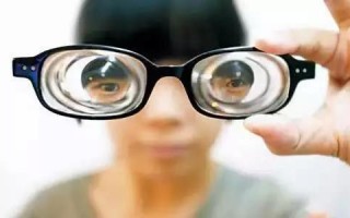 眼睛1.56是多少度，眼睛1.56是多少度近视