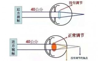 镜眼距离过近怎么样，镜眼距离过近怎么样矫正
