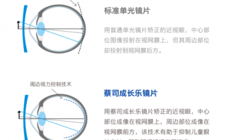 轴位为多少时镜片最薄，轴位越大镜片越厚吗
