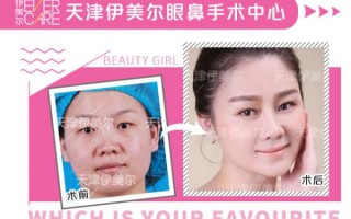 单眼皮怎么戴隐形眼镜，单眼皮怎么戴隐形眼镜好看